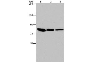 Western Blot analysis of Mouse skin tissue, HUVEC and Hela cell using Catenin gamma Polyclonal Antibody at dilution of 1:850 (JUP anticorps)