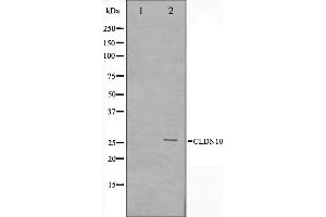 Western blot analysis on LOVO cell lysate using Claudin 10 Antibody,The lane on the left is treated with the antigen-specific peptide. (CLDN10 anticorps  (C-Term))