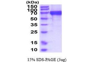 SDS-PAGE (SDS) image for Iduronate 2-Sulfatase (IDS) (AA 26-550) protein (His tag) (ABIN5854730) (IDS Protein (AA 26-550) (His tag))