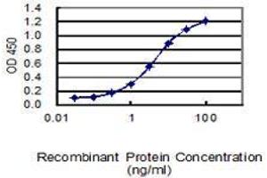 Detection limit for recombinant GST tagged SERPINB5 is 0.