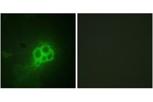 Immunofluorescence analysis of HuvEc cells, using Tryptophan Hydroxylase (Ab-260) Antibody.