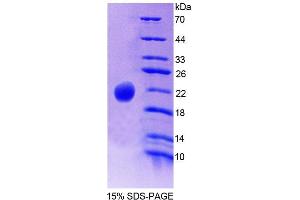 Image no. 1 for Phospholipase C beta 3, Phosphoinositide Specific (AA 318-468) protein (His tag) (ABIN4988769)