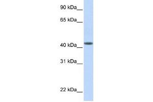 Western Blotting (WB) image for anti-DENN/MADD Domain Containing 1B (DENND1B) antibody (ABIN2459575) (DENND1B anticorps)
