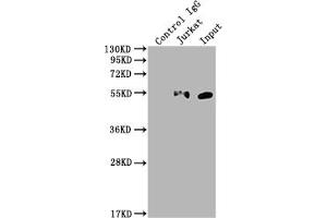 Immunoprecipitating KLF4 in Hela whole cell lysate Lane 1: Rabbit control IgG instead of ABIN7127591 in Hela whole cell lysate.