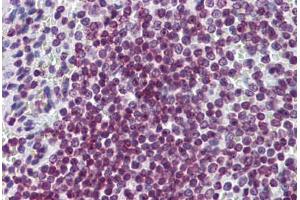 Human Spleen: Formalin-Fixed, Paraffin-Embedded (FFPE) (FOXO3 anticorps  (AA 361-460))