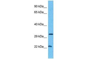 Host:  Rabbit  Target Name:  MINA  Sample Type:  Breast Tumor lysates  Antibody Dilution:  1. (MINA anticorps  (C-Term))