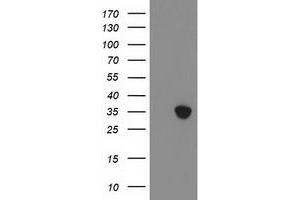HEK293T cells were transfected with the pCMV6-ENTRY control (Left lane) or pCMV6-ENTRY ZFP36 (Right lane) cDNA for 48 hrs and lysed.