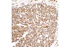 Immunohistochemistry (IHC) image for anti-DEAD (Asp-Glu-Ala-Asp) Box Polypeptide 1 (DDX1) (C-Term) antibody (ABIN7453882)