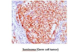 Immunohistochemistry (IHC) image for anti-FK506 Binding Protein 4, 59kDa (FKBP4) (AA 1-459), (N-Term) antibody (ABIN371865)