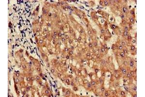Immunohistochemistry of paraffin-embedded human liver tissue using ABIN7162462 at dilution of 1:100 (SLC1A3 anticorps  (AA 7-151))