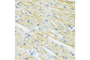Immunohistochemistry of paraffin-embedded mouse heart using SLC19A1 antibody (ABIN6291462) at dilution of 1:100 (40x lens).