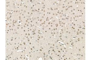 ABIN6264251 and ABIN6266824 at 1/100 staining Mouse brain tissue by IHC-P. (PKCB1 anticorps  (Internal Region))