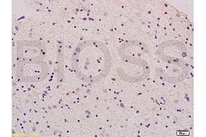 Immunohistochemistry (IHC) image for anti-Glial Cell Line Derived Neurotrophic Factor (GDNF) (AA 121-211) antibody (ABIN736536)