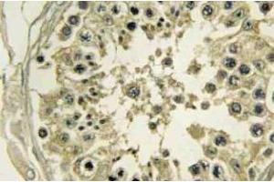 Immunohistochemistry analyzes of Hrs antibody in paraffin-embedded Human testis tissue. (HGS anticorps)