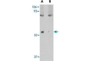 Western blot analysis of LGI1 in mouse brain tissue lysate with LGI1 polyclonal antibody  at 1 ug/mL in (A) the absence and (B) the presence of blocking peptide. (LGI1 anticorps  (N-Term))