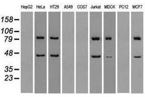 Image no. 4 for anti-Sjogren Syndrome Antigen B (SSB) antibody (ABIN1501143)