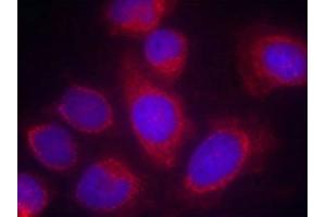 Immunofluorescence staining of methanol-fixed Hela cells using CPI17a(Ab-38) Antibody.