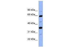 WB Suggested Anti-SERPINC1 Antibody Titration:  0. (SERPINC1 anticorps  (Middle Region))