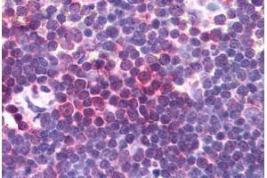 Human Thymus (formalin-fixed, paraffin-embedded) stained with AURKA antibody ABIN292641 at 10 ug/ml followed by biotinylated anti-goat IgG secondary antibody ABIN481715, alkaline phosphatase-streptavidin and chromogen. (Aurora A anticorps  (AA 394-403))