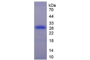 Image no. 1 for Mitogen-Activated Protein Kinase 3 (MAPK3) (AA 75-312) protein (His tag) (ABIN6236744) (ERK1 Protein (AA 75-312) (His tag))