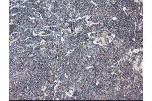 Image no. 1 for anti-Receptor (TNFRSF)-Interacting serine-threonine Kinase 1 (RIPK1) (AA 133-422) antibody (ABIN1490909)