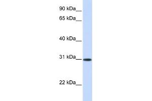 WB Suggested Anti-ATF5 Antibody Titration: 0.
