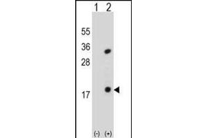 Western blot analysis of PLA2G1B (arrow) using rabbit polyclonal PLA2G1B Antibody (C-term) (ABIN651072 and ABIN2840059).