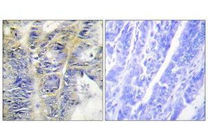 Immunohistochemistry (IHC) image for anti-Collagen, Type IV, alpha 5 (COL4A5) (N-Term) antibody (ABIN1850286) (COL4a5 anticorps  (N-Term))