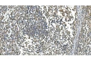 IHC analysis of LSM7 using anti-LSM7 antibody (ABIN7598937). (LSM7 anticorps  (AA 1-103))