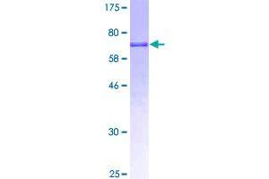Image no. 1 for Glycine Amidinotransferase (L-Arginine:glycine Amidinotransferase) (GATM) (AA 1-423) protein (GST tag) (ABIN1354857)