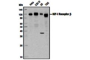 Image no. 3 for anti-Insulin-Like Growth Factor 1 Receptor (IGF1R) (C-Term) antibody (ABIN228595) (IGF1R anticorps  (C-Term))