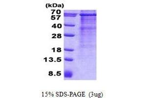 Image no. 1 for Mitochondrial Antiviral Signaling Protein (MAVS) protein (His tag) (ABIN6387120) (MAVS Protein (His tag))
