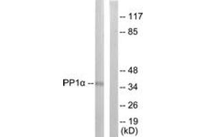 Western Blotting (WB) image for anti-Protein Phosphatase 1, Catalytic Subunit, alpha Isoform (PPP1CA) (AA 281-330), (pThr320) antibody (ABIN482082) (PPP1CA anticorps  (pThr320))