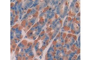 IHC-P analysis of stomach tissue, with DAB staining. (DPP3 anticorps  (AA 2-263))