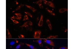 Immunofluorescence analysis of U-2OS cells using MCTS1 Polyclonal Antibody at dilution of 1:100 (40x lens). (MCTS1 anticorps)