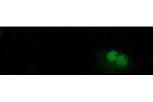 Image no. 3 for anti-beta-Transducin Repeat Containing (BTRC) (AA 52-354) antibody (ABIN1491576)