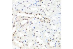 Immunohistochemistry of paraffin-embedded rat kidney using HNRNPCL1 antibody (ABIN5995850) at dilution of 1/100 (40x lens).