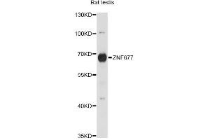 Western blot analysis of extracts of rat testis, using ZNF677 antibody. (ZNF677 anticorps)