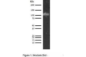 Western Blotting (WB) image for anti-ADAM Metallopeptidase with Thrombospondin Type 1 Motif, 13 (ADAMTS13) antibody (ABIN5566846) (ADAMTS13 anticorps)