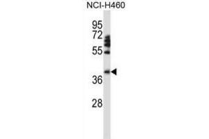 Western Blotting (WB) image for anti-Forkhead Box D1 (FOXD1) antibody (ABIN2997954)