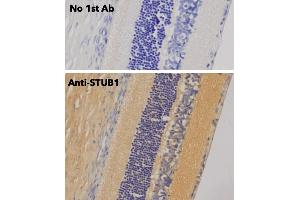 Immunohistochemistry (IHC) image for anti-STIP1 Homology and U-Box Containing Protein 1 (STUB1) antibody (ABIN6254206) (STUB1 anticorps)