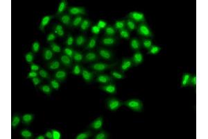 Immunofluorescence analysis of A549 cells using PHF11 antibody. (PHF11 anticorps)