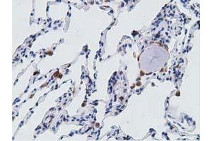 Immunohistochemical staining of paraffin-embedded Human lung tissue using anti-PECR mouse monoclonal antibody. (PECR anticorps)