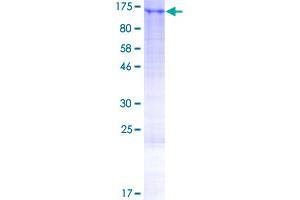 Image no. 1 for Leucine Zipper Protein 1 (LUZP1) (AA 1-1026) protein (GST tag) (ABIN1309892)