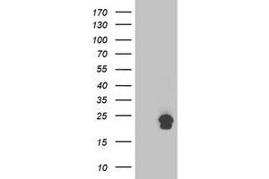 anti-Transmembrane Emp24 Protein Transport Domain Containing 1 (TMED1) antibody