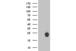 Image no. 1 for anti-Transmembrane Emp24 Protein Transport Domain Containing 1 (TMED1) antibody (ABIN1501414) (TMED1 anticorps)