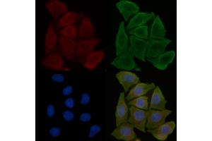 ABIN6258319 and ABIN6275775 staining Hela cells(30 min of UV treatment) by IF/ICC. (IFIT5 anticorps  (Internal Region))