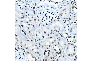 Immunohistochemistry of paraffin-embedded rat kidney using K Rabbit pAb (ABIN6128005, ABIN6142689, ABIN6142690 and ABIN6221516) at dilution of 1:100 (40x lens).