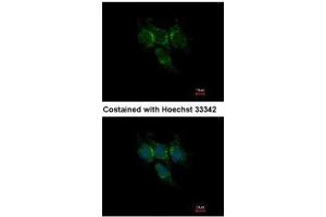 ICC/IF Image Immunofluorescence analysis of methanol-fixed Hep3B, using GSTA1, antibody at 1:500 dilution. (GSTA1 anticorps)