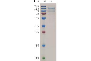 Human Protein, His Tag on SDS-PAGE under reducing condition.